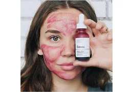 همه چیز درباره سرم پیلینگ اوردینری AHA 30% + BHA 2%